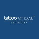 Tattoo removal Australia